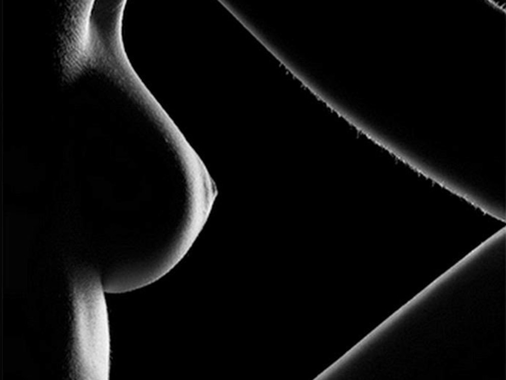 mamoplastia